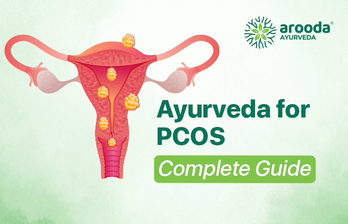 Ayurvedic Treatment for PCOS - Complete Guide